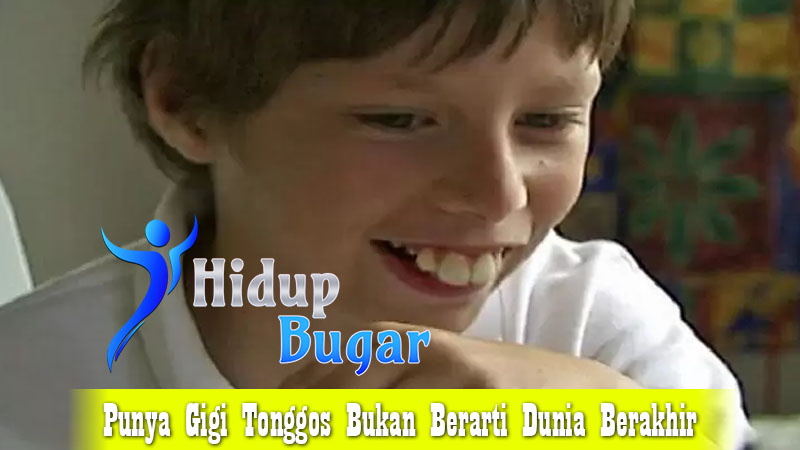 Punya Gigi Tonggos Bukan Berarti Dunia Berakhir