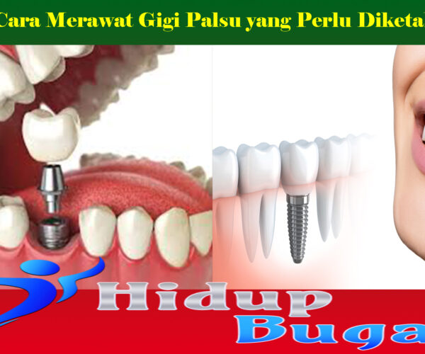 Cara Merawat Gigi Palsu yang Perlu Diketahui