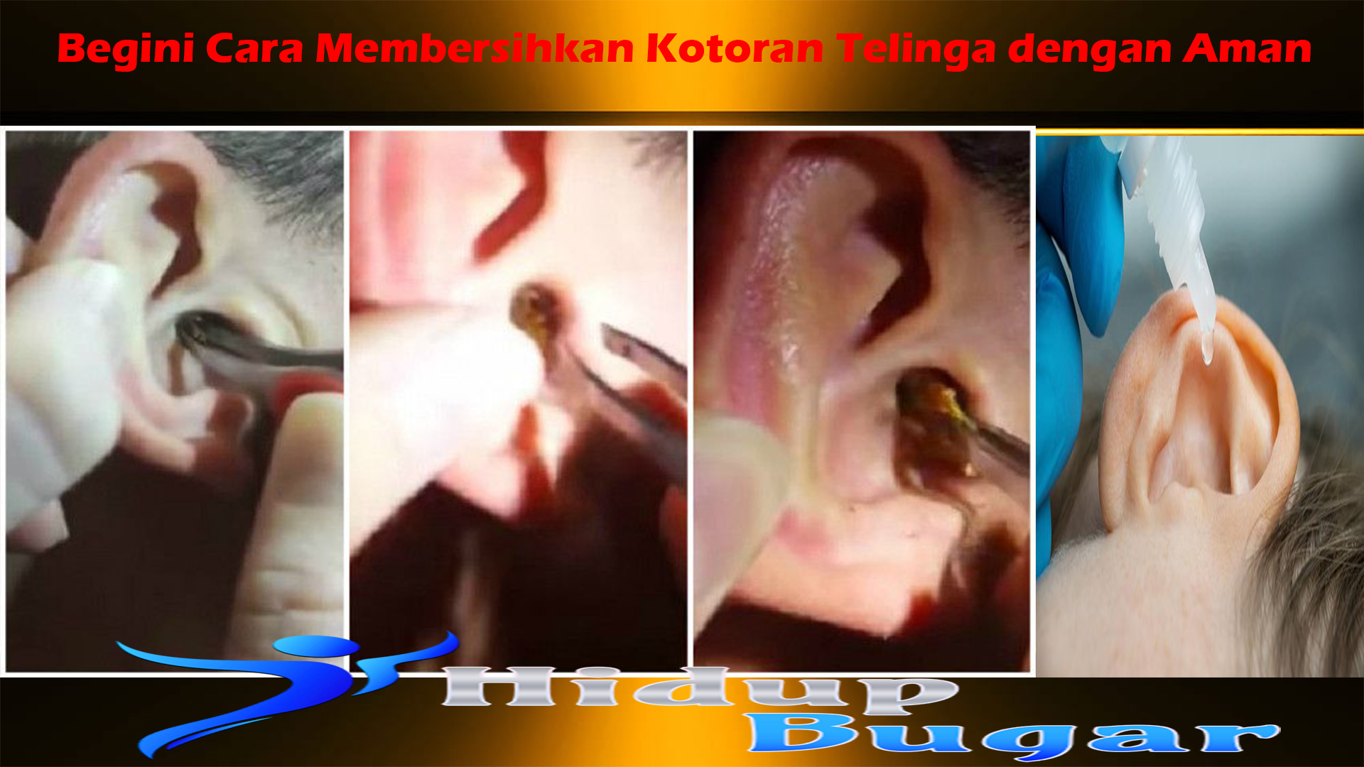 Begini Cara Membersihkan Kotoran Telinga dengan Aman