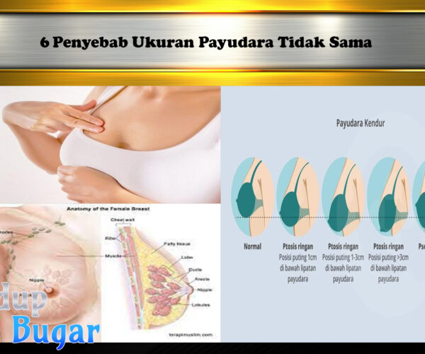 6 Penyebab Ukuran Payudara Tidak Sama