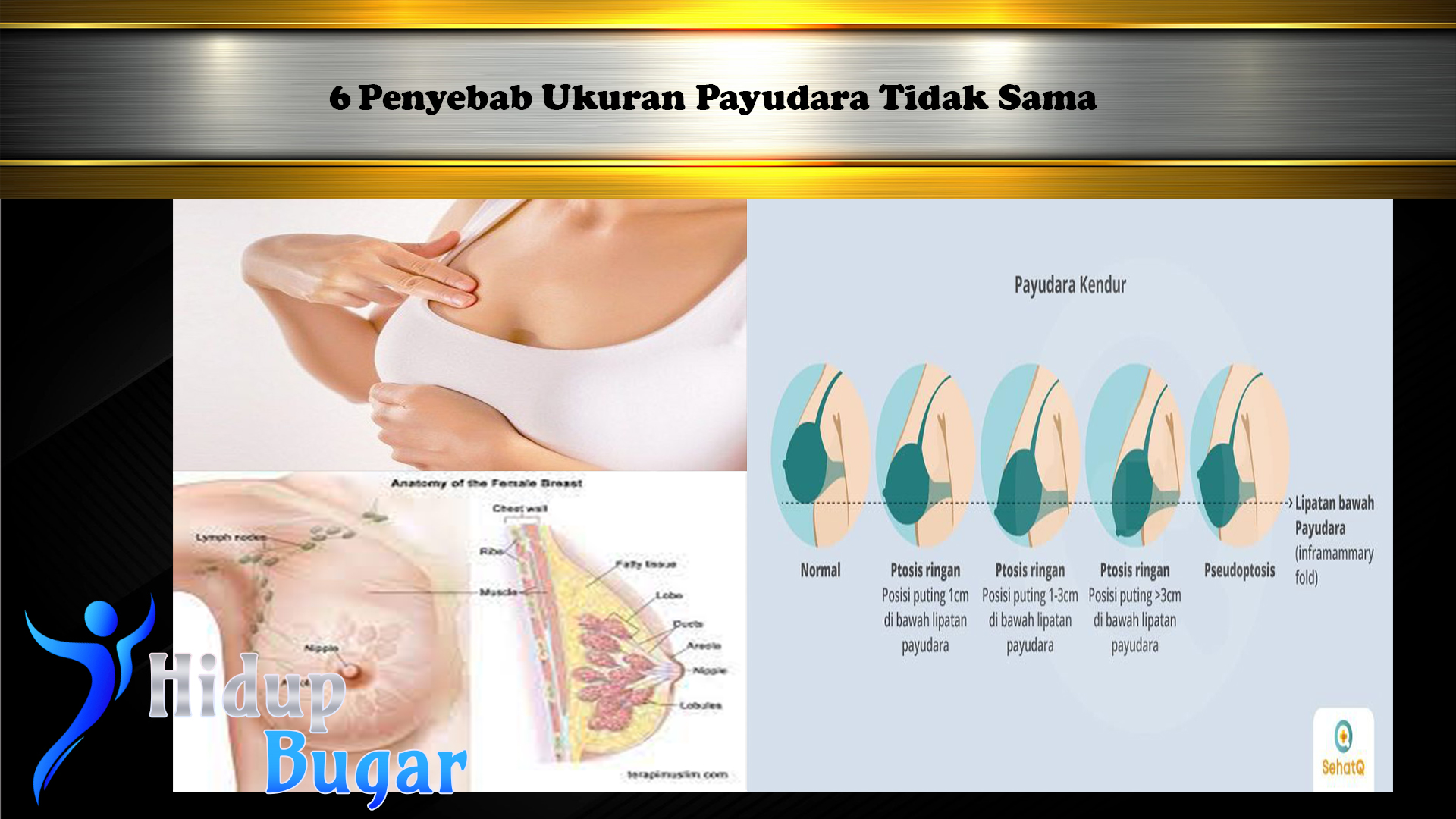 6 Penyebab Ukuran Payudara Tidak Sama