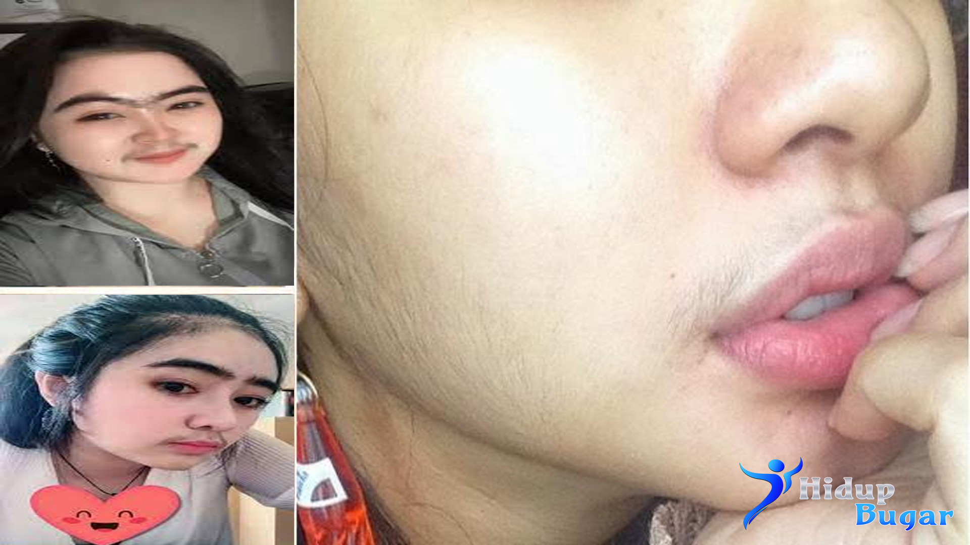 Ini Penyebab Wanita Berkumis dan Cara Mengatasinya